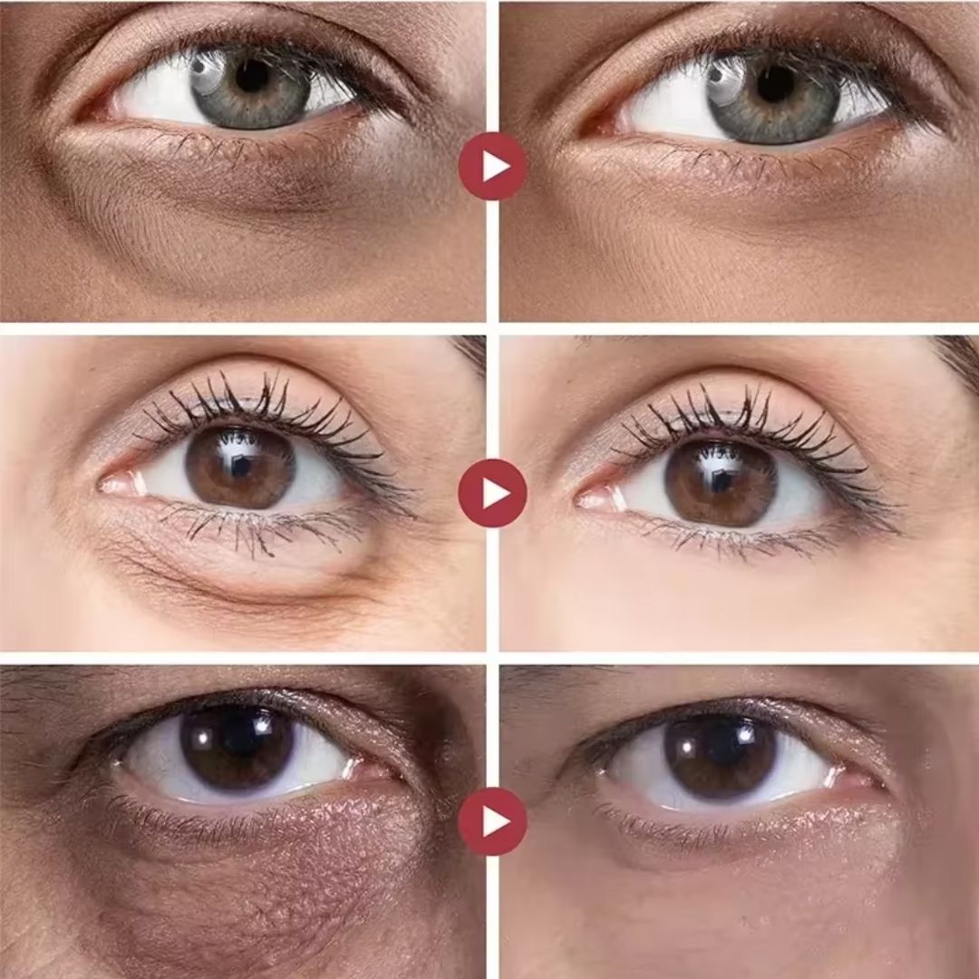 Ultra Rejuvenating 5-in-1 Roll-On - Luteína Glow®